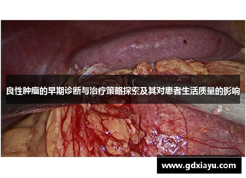 良性肿瘤的早期诊断与治疗策略探索及其对患者生活质量的影响